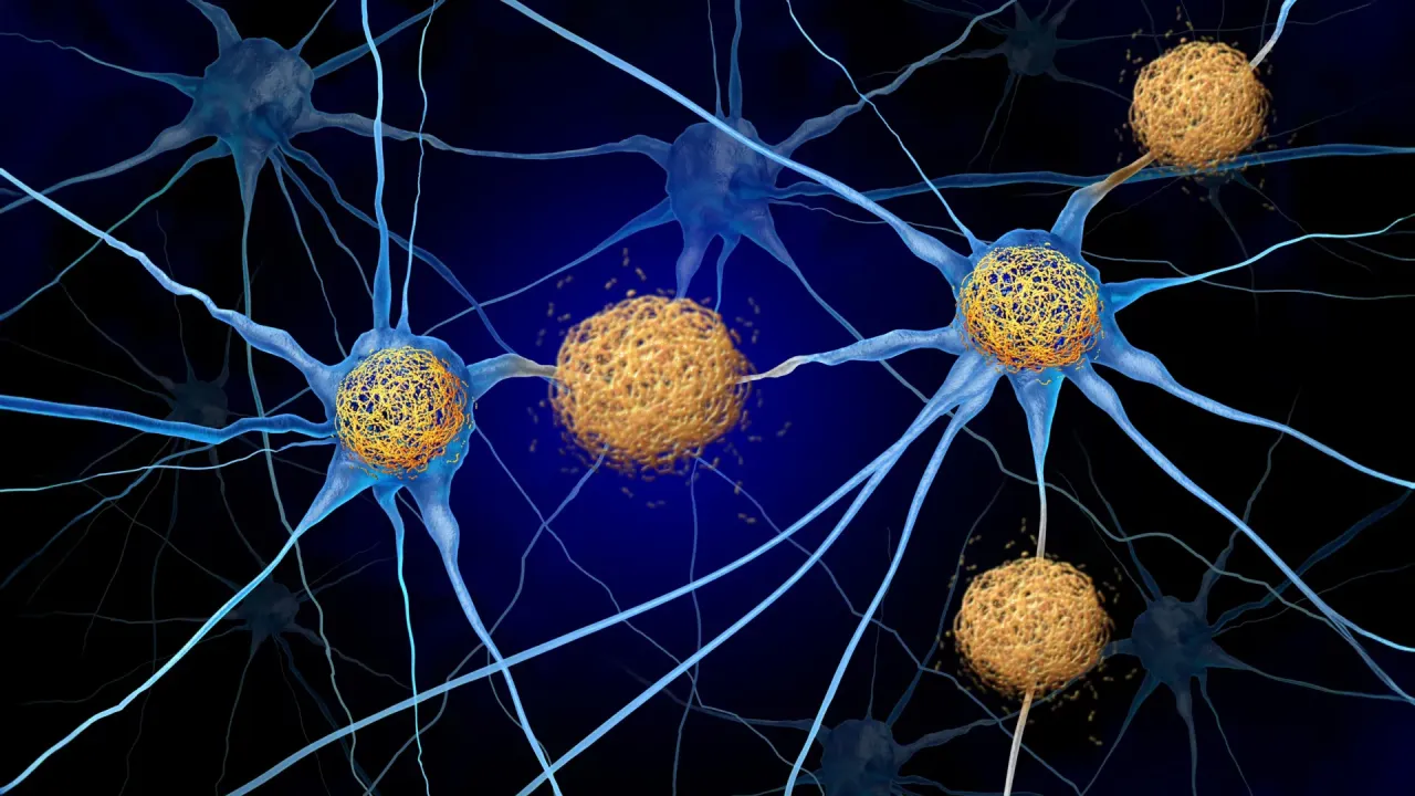 Alzheimer Hastalığının Görmezden Gelinen Suçlusunu Keşfeden UC Santa Cruz Araştırması
