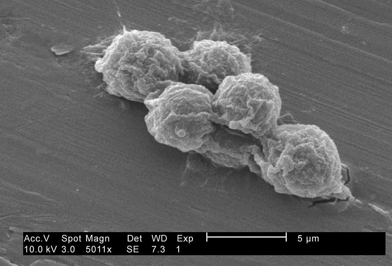 Vermamoeba vermiformis amibi, taramalı elektron mikroskobunda
